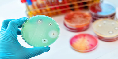 Everything You Need To Know About Antimicrobials Everything You Need To Know About Antimicrobials
