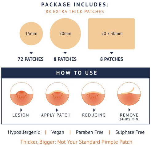 Treat Molluscum Contagiosum in Adults and Children. Natural Products