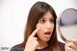 ​What Causes Dark Circles Under Your Eyes?