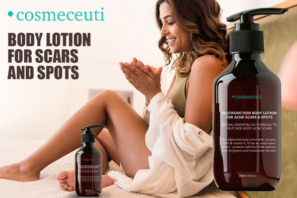 Body Lotion For Acne Scars & Spots
