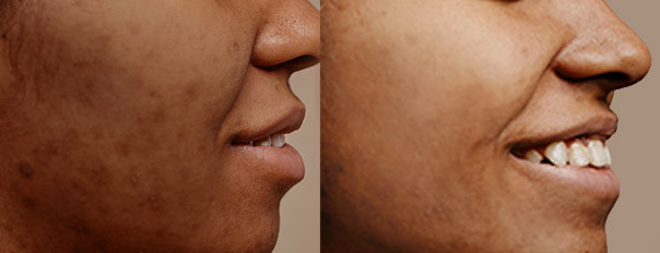 Glutathione Boost Skin Lightening Supplement. High  Strength Formula - 60 Day Supply