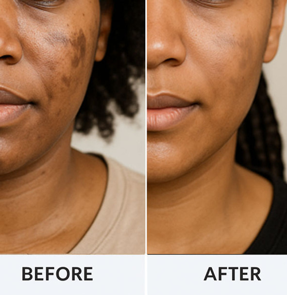 30 day Skin Lightening System - Two Products