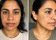 Intense Skin Lightening Cream - All Natural With Powerful Antioxidants Intense Skin Lightening Cream - All Natural With Powerful Antioxidants