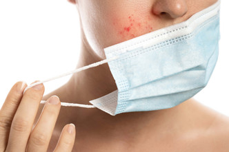 A Guide To Getting Rid Of Stubborn Maskne A Guide To Getting Rid Of Stubborn Maskne