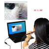 HD Visible Ear Spoon Medical Ear Cleaning Endoscope 0.3MP High Definition Inspection Snake Tube Pipe Camera for Laptop Phone