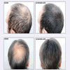 3 pcs TOPPIK 27.5 g  hair building fiber 9 colors  full hair instantly hair fiber 