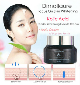 Dimollaure Kojic Acid whitening cream 30g Retinol Wrinkle removal Freckle melasma Acne scar pigment age spot melanin sun spot 