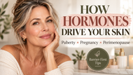 How Hormones Affect Your Skin: Acne, Dryness & Perimenopause