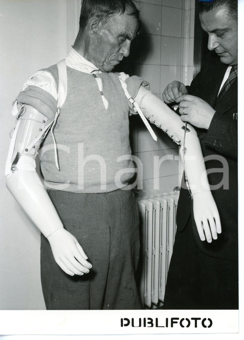 1955 ROMA Mutilato da ambo le braccia riceve protesi da benefattore - Foto 13x18