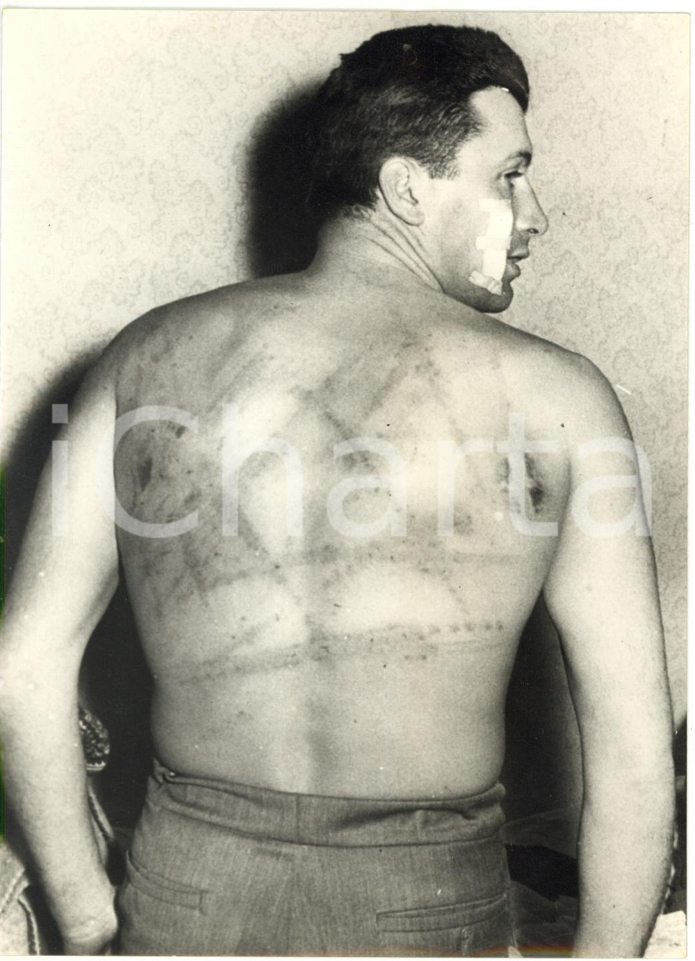 1957 VIENNA Pallanuotista Dezső GYARMATI mostra cicatrici di torture sovietiche