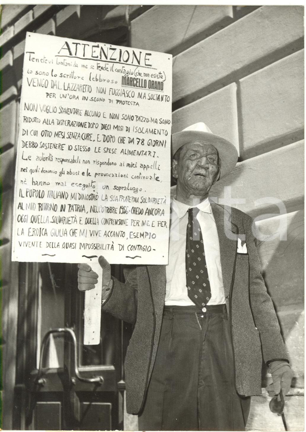 1956 ROMA Scrittore lebbroso Marcello ORANO protesta dopo la fuga dal lazzaretto