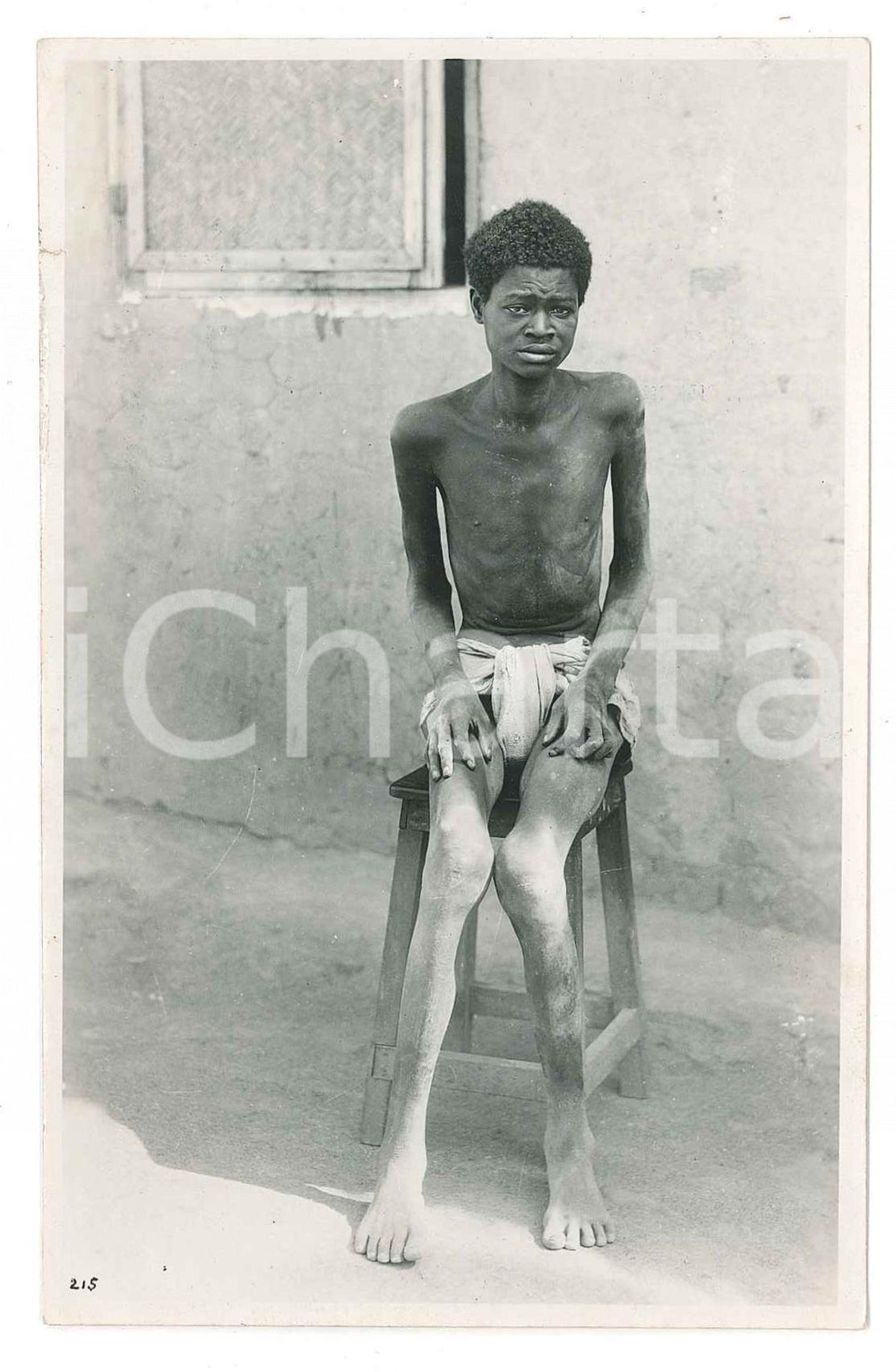 1930 C. ZAGOURSKI «L'Afrique qui disparaît» Congo-Océan - Natif malade Postcard  Fotografia seriale d'epoca, appartenente alla serie &laquo;L'Afrique qui dispara&icirc;t&raquo; del fotografo Casimir Zagourski (L&eacute;opoldville).CONDIZIONI: POOR (strappo al margine sinistro, abrasione al verso lungo il margine destro)FORMATO: 14x9 cm    originale e autentica 1