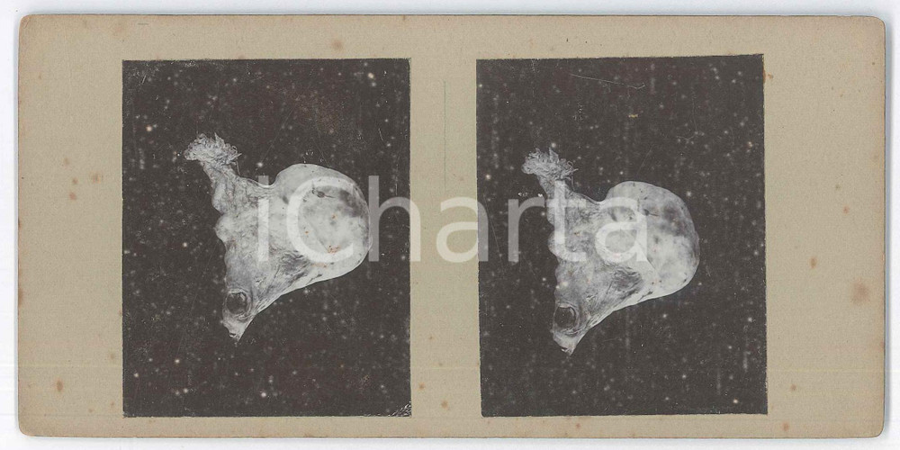 1910 ca AUTOPSIES - Human body - RARE MEDICAL Stereoview (9) Fotografia stereoscopica d'epoca, su cartoncino rigido. FAIR/discreto fioriture, difetti Formato: 18x9 cm originale e autentica 1
