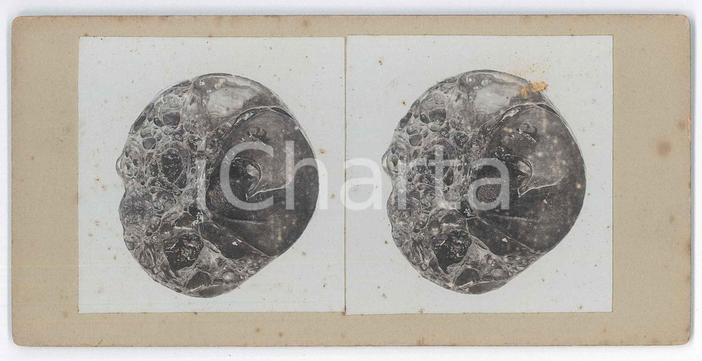 1910 ca AUTOPSIES - Human body - RARE MEDICAL Stereoview (2) Fotografia stereoscopica d'epoca, su cartoncino rigido. FAIR/discreto fioriture Formato: 18x9 cm originale e autentica 1