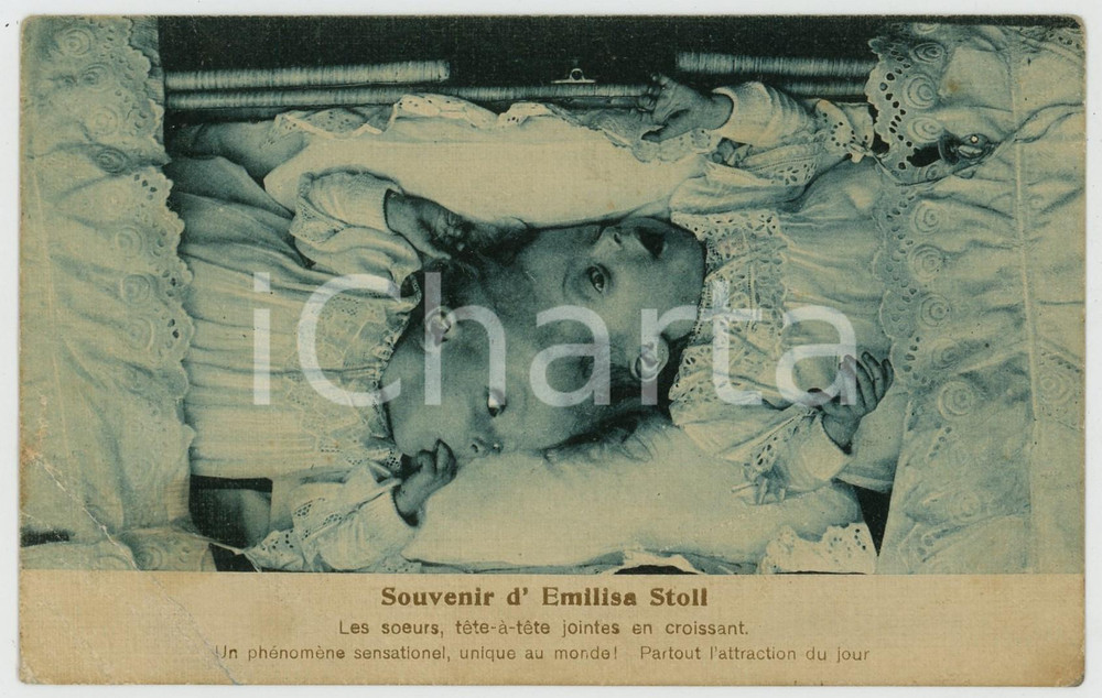 1910 ca  Emilisa STOLL Siamese twins conjoined at head - French postcard  Cartolina postale d'epoca, non viaggiata. VERY POOR/gravemente danneggiato piegature evidenti al margine inferiore Formato: 14x9 cm originale e autentica 1