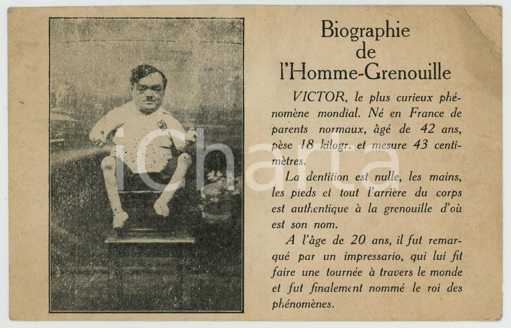 1910 ca CIRCUS FREAKS Victor l'Homme-Grenouille roi des phénomènes - Postcard  Cartolina postale d'epoca, priva della divisione al verso.CONDIZIONI: POOR (piegature)FORMATO: FP    originale e autentica 1