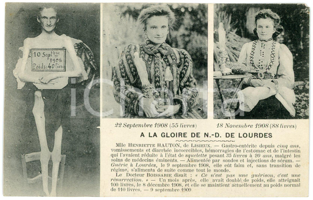 1910 ca LOURDES - Miracles - ANOREXIE - Henriette HAUTON - CPA Carte postale  Cartolina postale d'epoca, non viaggiata.CONDIZIONI: F (minima mancanza angolare; piccolo foro di affissione al lato inferiore)FORMATO: FP    originale e autentica 1