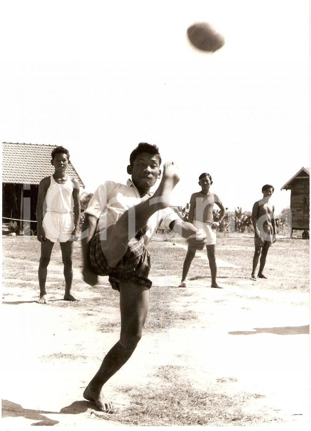 Fotografia d epoca originale 1978 BIRMANIA Calciatore lebbroso guarisce grazie allo sport WHO PHOTO 1