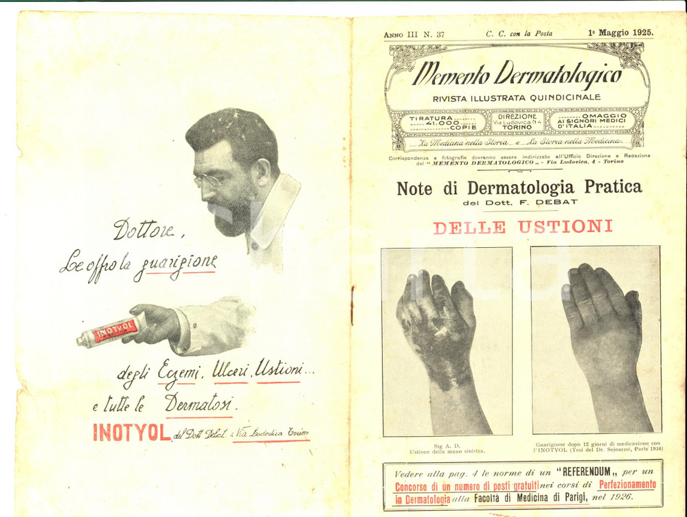 Giornale, rivista storica 1925 TORINO Memento dermatologico  Dott. DEBAT Delle ustioni Rivista 1