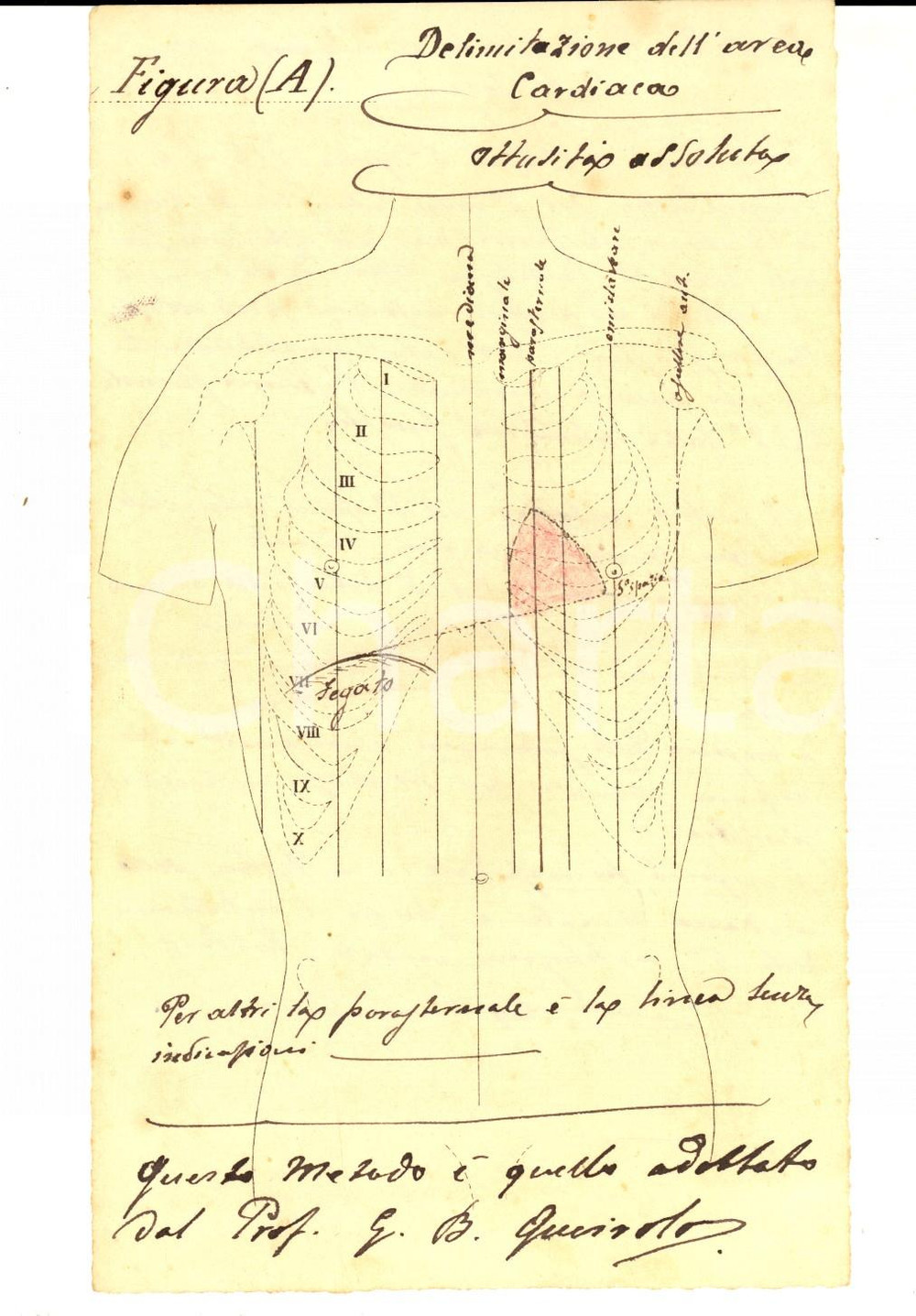 Stampa, bozzetto originale 1880 ca MEDICINA Disegno area cardiaca e polmonare  metodo QUEIROLO China 1