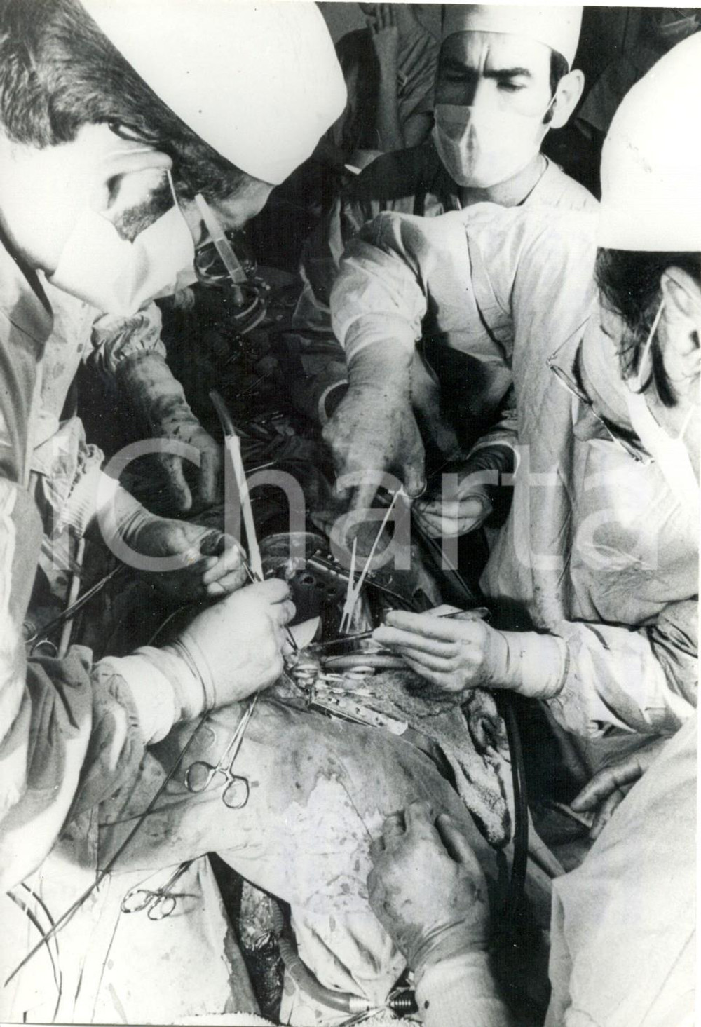 Fotografia d epoca originale 1972 MADRID  Trapianto cuore artificiale  CristÃ³bal MARTINEZBORDIU Foto 1