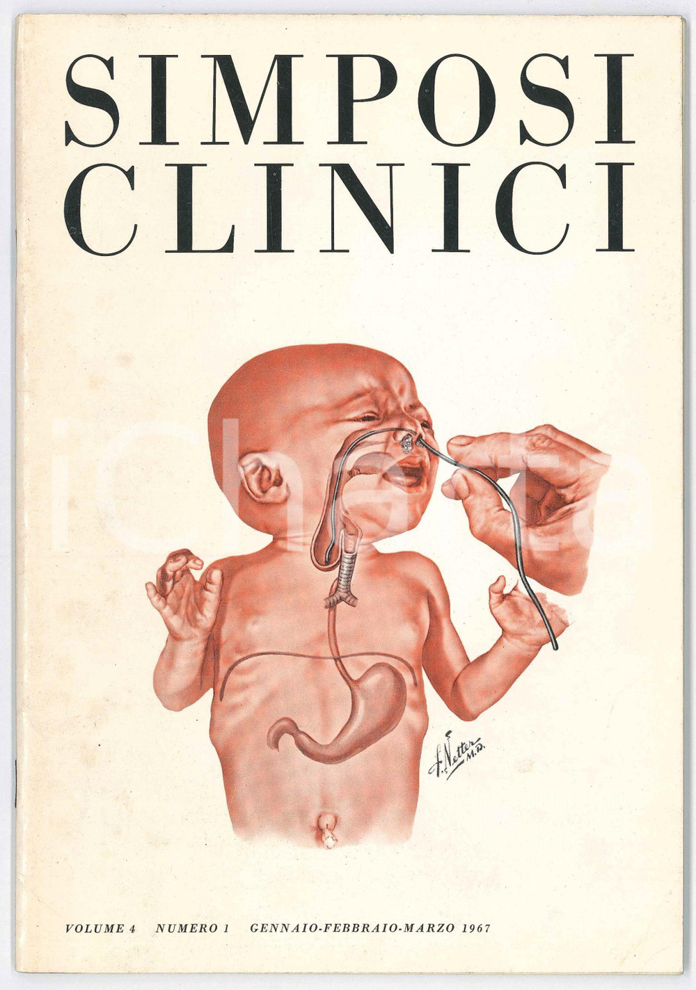 Giornale, rivista storica 1967 SIMPOSI CLINICI Vol.4 n.1  Radiogrammi primo caso di James PAGET Rivista 1
