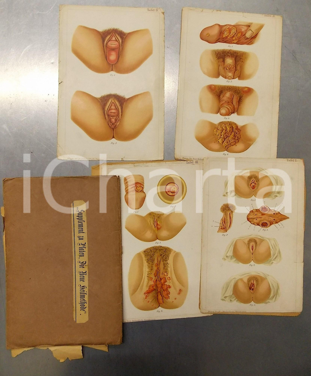 Giornale, rivista storica 1900 ca Supplement Zu Platen  Die Neue Heilmethode  Geschlechtskrankheiten 1