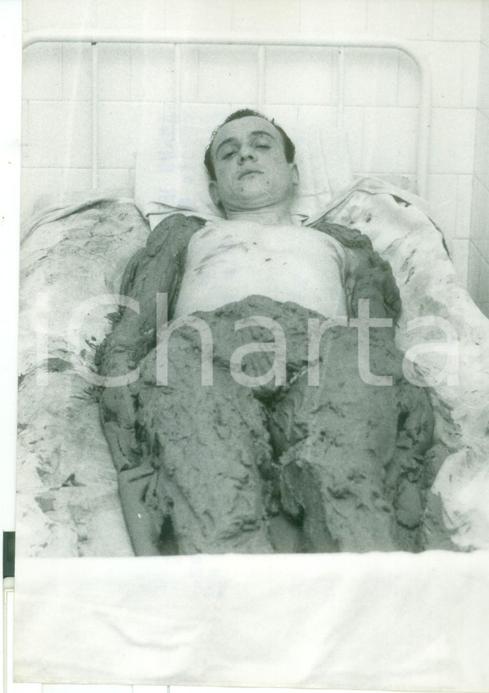 Fotografia d epoca originale 1958 ABANO TERME  Ercole BALDINI ricoperto di fango durante cura termale  Foto 1