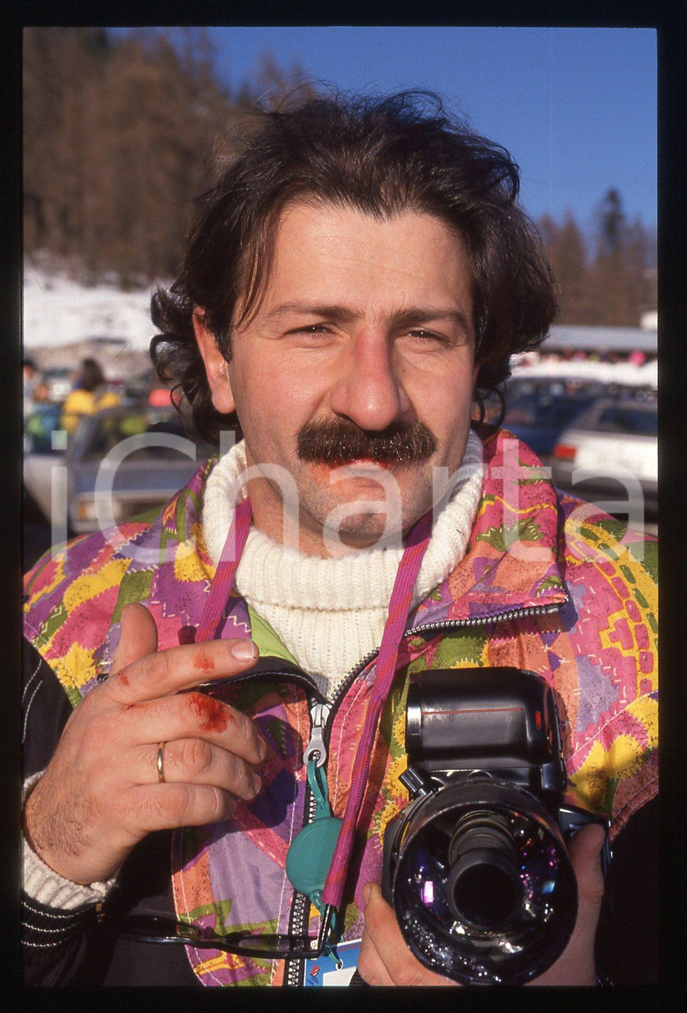 35mm vintage slide*1990ca CORTINA D'AMPEZZO Riccardo FREZZA dopo aggressione 2