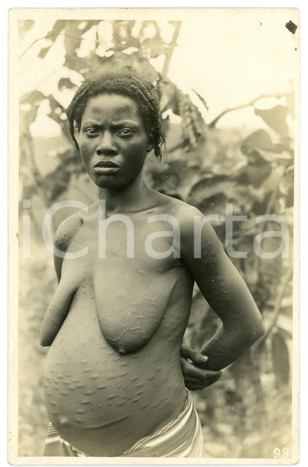 1930 ca CONGO BELGE Femme indigène enceinte - Scarification *Photo L. GABRIEL 99 Fotografia originale d'epoca, in formato cartolina postale. GOOD/buono minimo residuo cartaceo all'angolo superiore destro e minima piegature angolare Formato: 9x14 cm originale e autentica 1