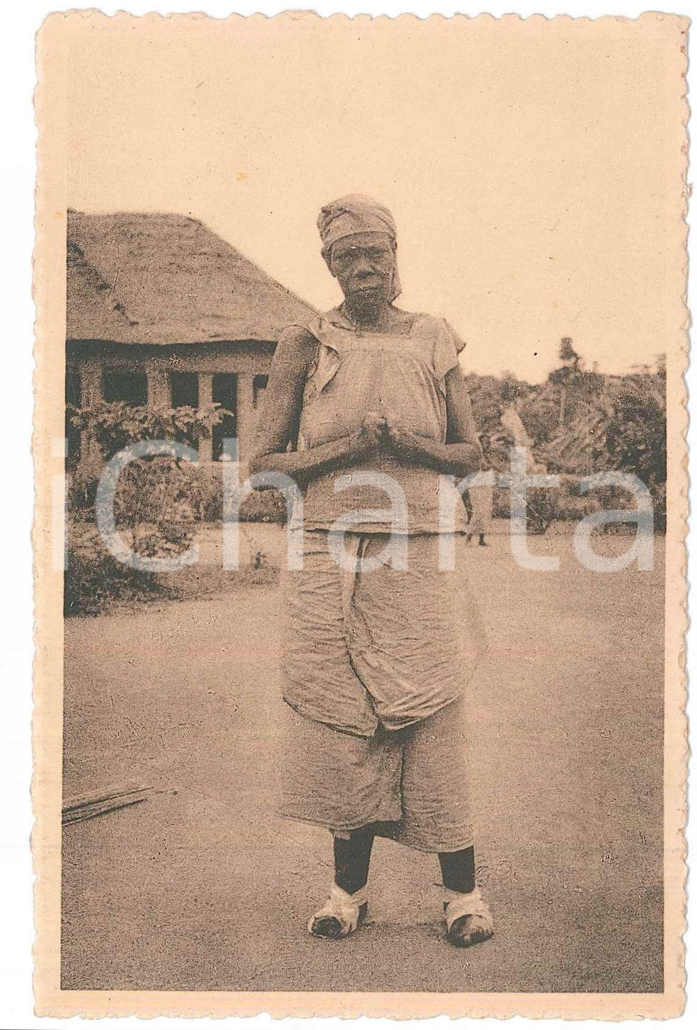 1930 ca LOMBOLOMBO - WAFANDA Type de lépreuse - Forme nerveuse - Carte postale  Cartolina d'epoca, non viaggiata. FAIR/discreto Lievi smussature agli angoli Formato: 14x9 originale e autentica 1