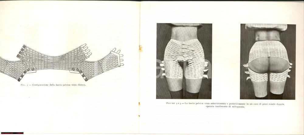 Materiale pubblicitario d’epoca 1920 ca TORINO Fascia pelvica dott. Guglielmo BRACCO Libretto RARO 1
