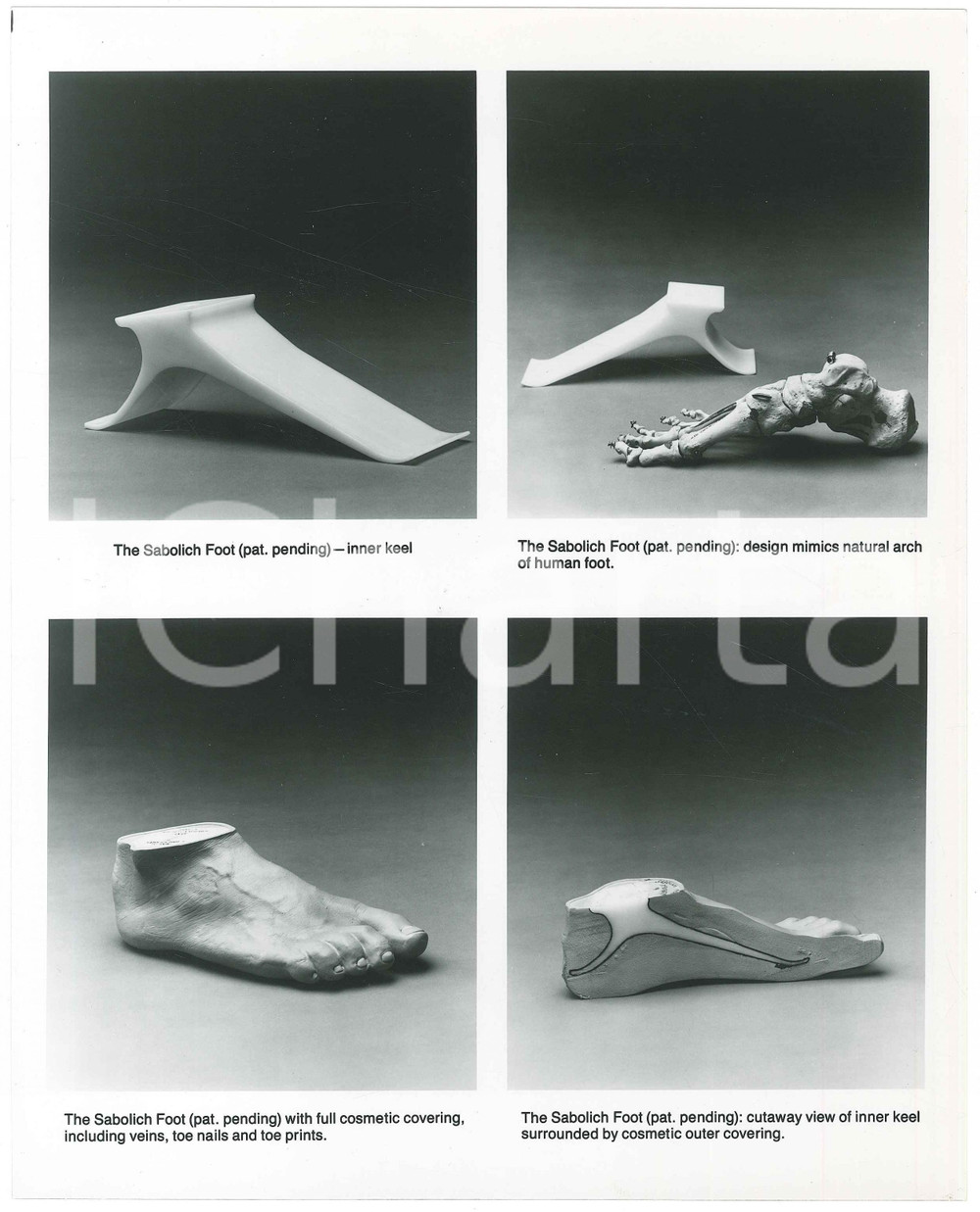 Fotografia d epoca originale 1985 ca OKLAHOMA CITY The Sabolich Foot  Prosthetics  Photo 20x25 cm 1 1
