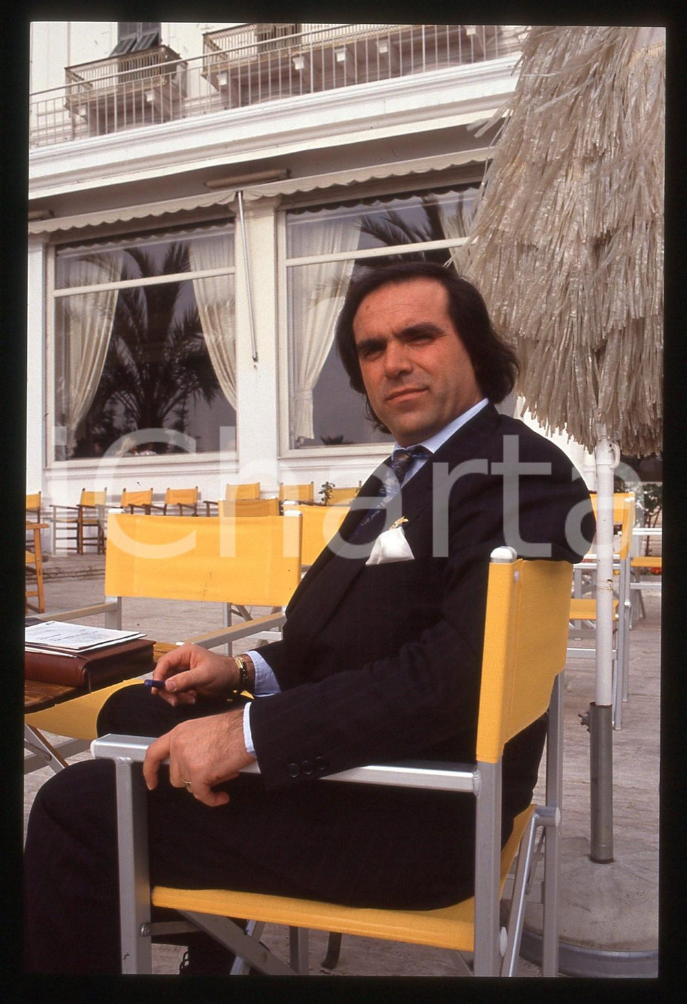 35mm vintage slide* 1985ca Tony GALLO pioniere trapianto tricologico -ritratto 9