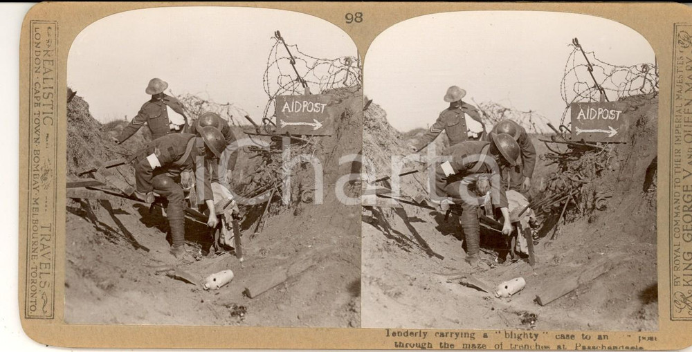 Fotografia d epoca originale 1918 WW1 THE GREAT WAR PASSCHENDAELE Carrying a blighty case Stereoscopic n° 98 1