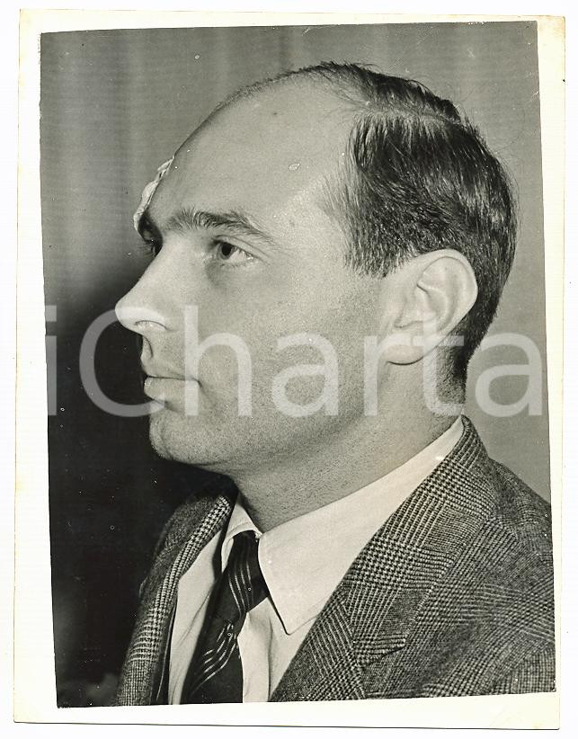 1955 LONDON Alexander II of Yugoslavia with a patch after car crash *Photo