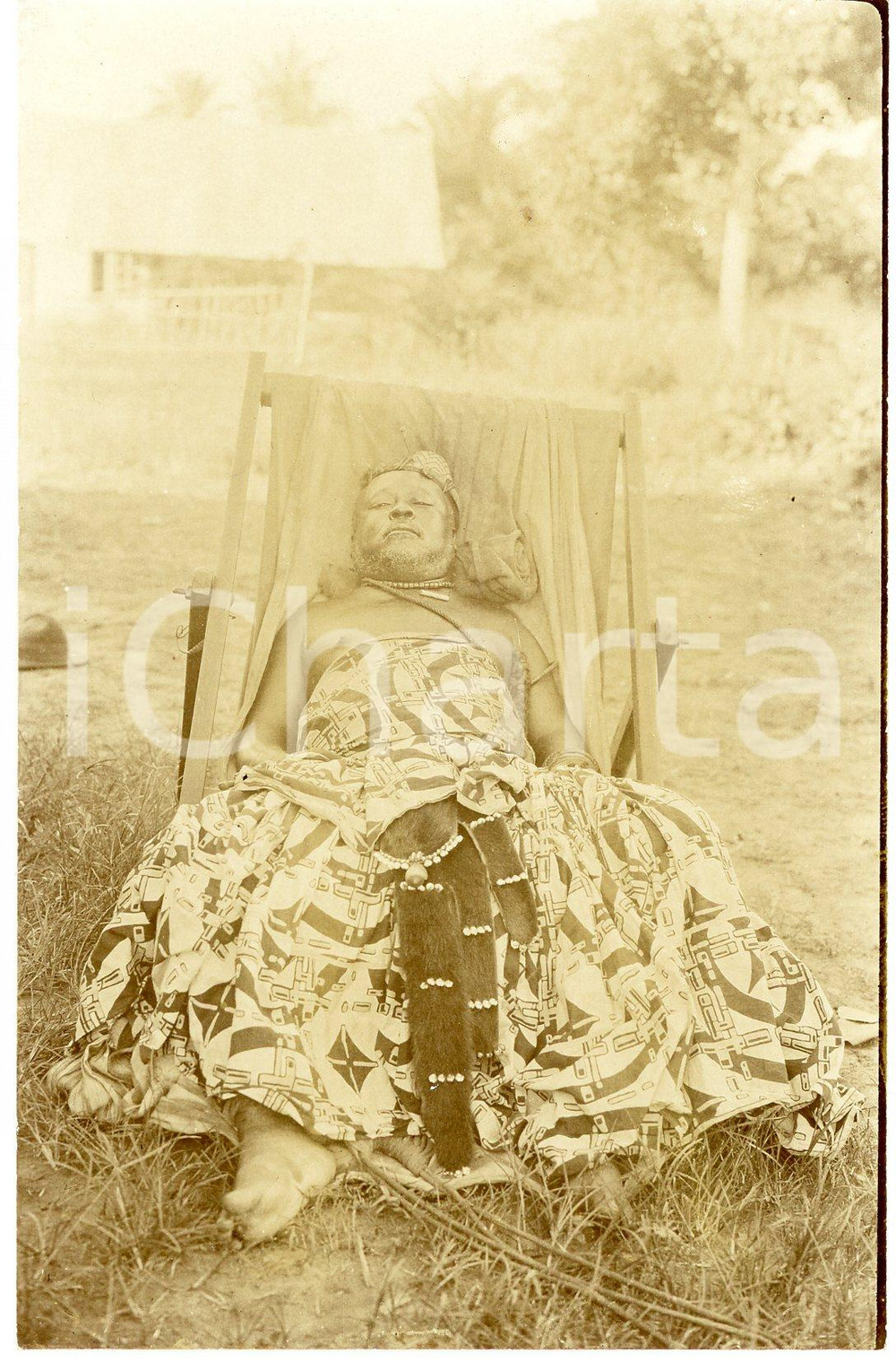 1930 ca CONGO BELGE Portrait d'indigÃ¨ne assis - ElÃ©phantiasis *Photo 9x14 cm Fotografia d'epoca, in formato cartolina postale.  GOOD/buono  FORMATO: 9x14 cm originale e autentica 1