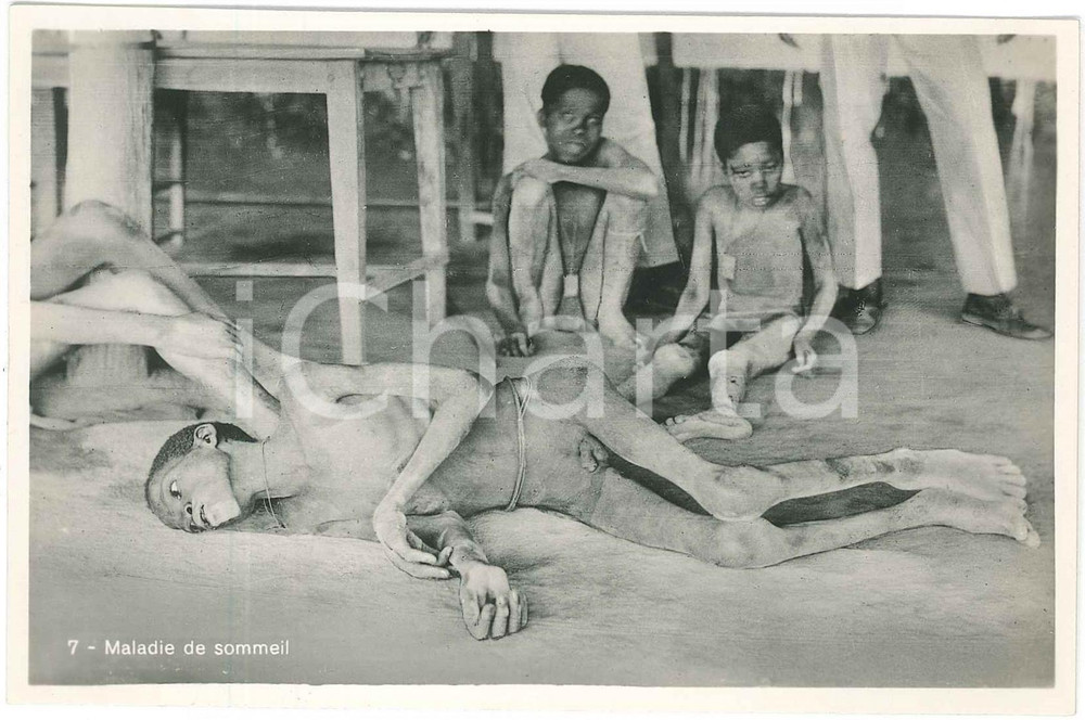 1930ca C. ZAGOURSKI «L'Afrique qui disparaît» Maladies tropicales - Postcard 166  Fotocartolina postale d'epoca, appartenente alla serie &laquo;L'Afrique qui dispara&icirc;t&raquo; del fotografo Casimir Zagourski (L&eacute;opoldville).N&deg; 166, non viaggiata.CONDIZIONI: GFORMATO: 9x14 cm    originale e autentica 1