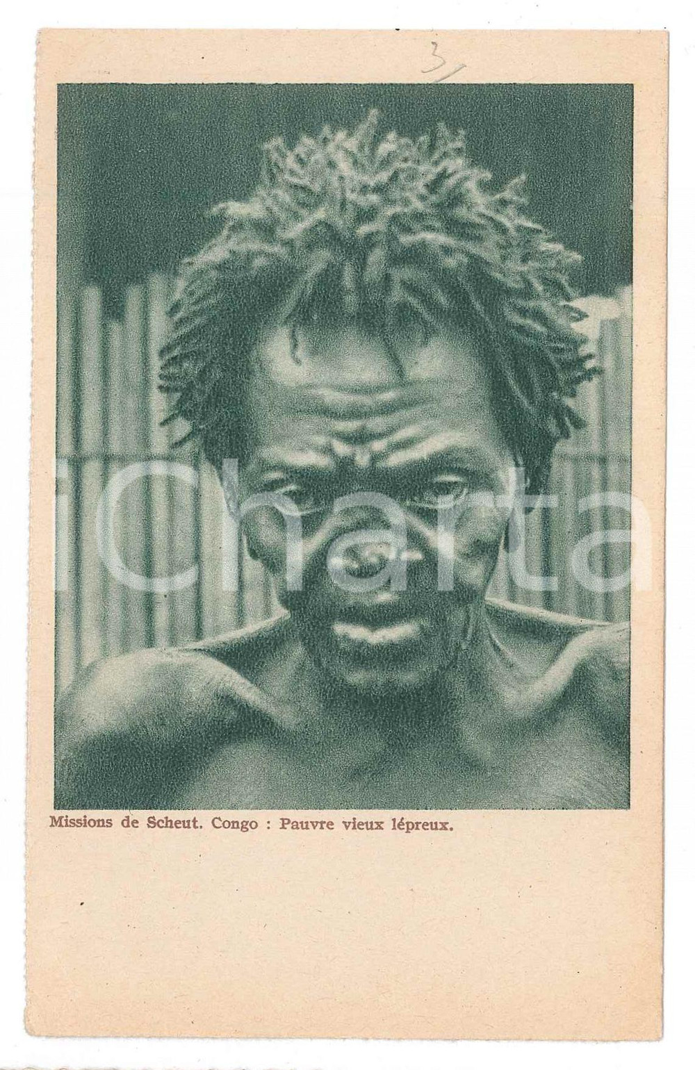 Cartolina originale da collezione 1937 CONGO BELGE Missions de Scheut  Pauvre vieux lÃ©preux  Carte postale FP VG 1