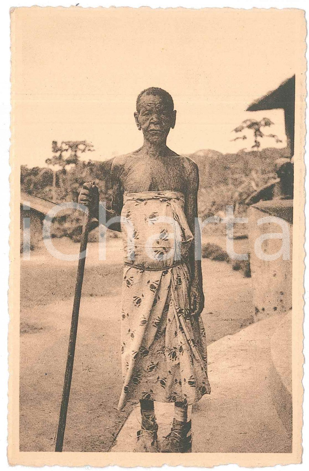 1930 ca LOMBOLOMBO WAFANDA Type de lépreuse - Forme lépromateuse - Carte postale  Cartolina d'epoca, non viaggiata.  FAIR/discreto Lievi smussature agli angoli FORMATO: 14x9 originale e autentica 1