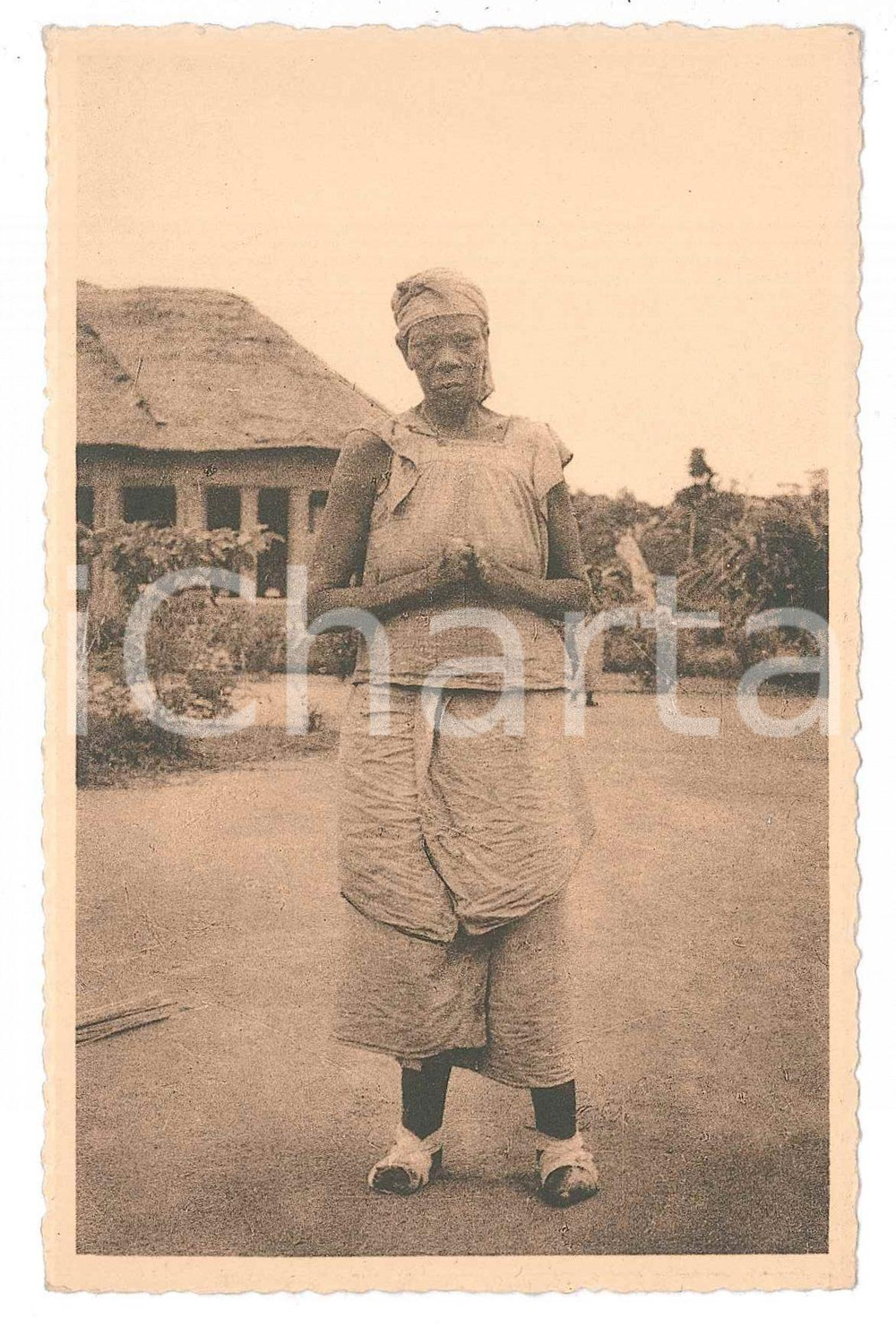 1930 ca LOMBOLOMBO - WAFANDA Type de lépreuse - Forme nerveuse ^Carte postale  Cartolina d'epoca, non viaggiata. FAIR/discreto Lievi smussature agli angoli Formato: 14x9 originale e autentica 1