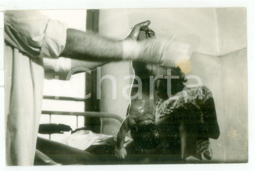 Fotografia d epoca originale 1970 ca MOZAMBICO Ospedale  Parto di una donna  Foto reportage medico 14x9 1