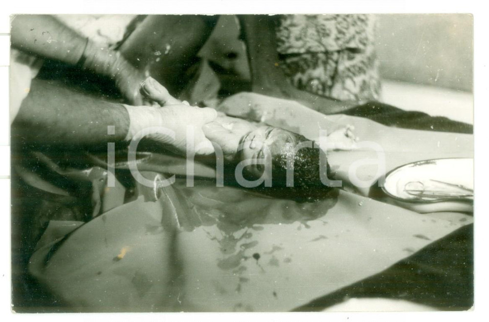 Fotografia d epoca originale 1970 ca MOZAMBICO Ospedale  Parto di una donna  Foto reportage medico 14x9 1