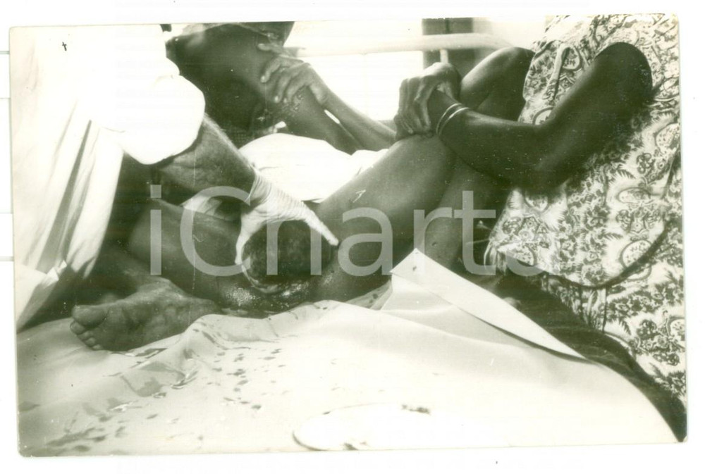 Fotografia d epoca originale 1970 ca MOZAMBICO Ospedale  Parto di una donna  Foto reportage medico 14x9 1