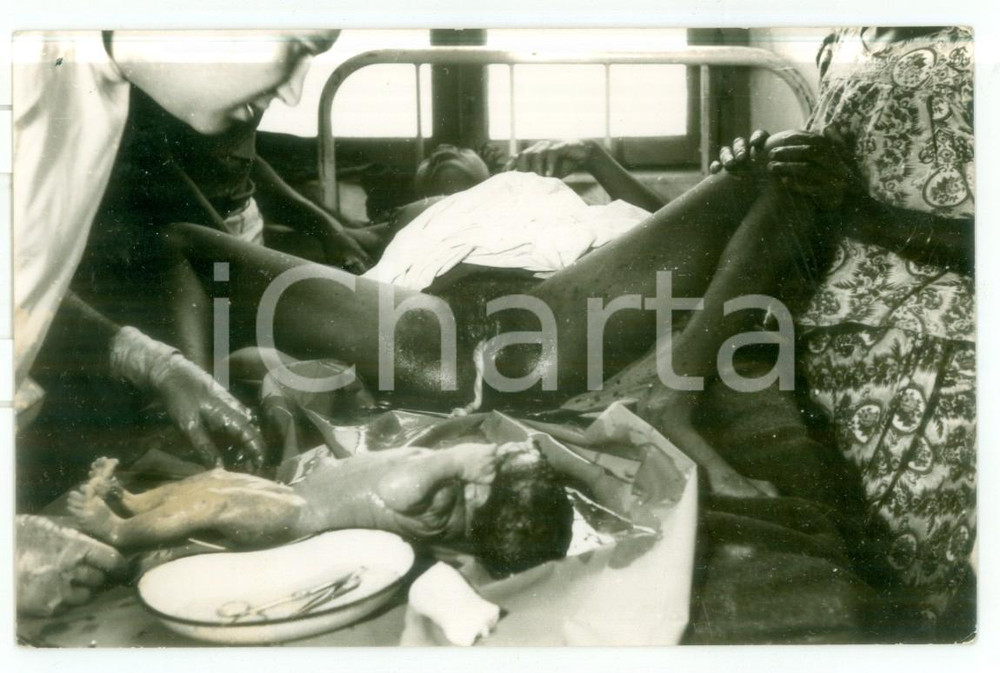 Fotografia d epoca originale 1970 ca MOZAMBICO Ospedale  Parto di una donna  Foto reportage medico 14x9 1