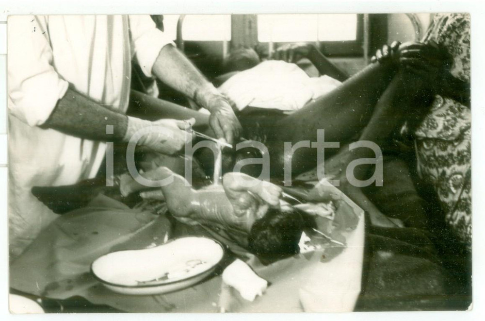 Fotografia d epoca originale 1970 ca MOZAMBICO Ospedale  Parto di una donna  Foto reportage medico 14x9 1
