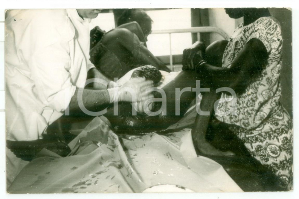 Fotografia d epoca originale 1970 ca MOZAMBICO Ospedale  Parto di una donna  Foto reportage medico 14x9 1