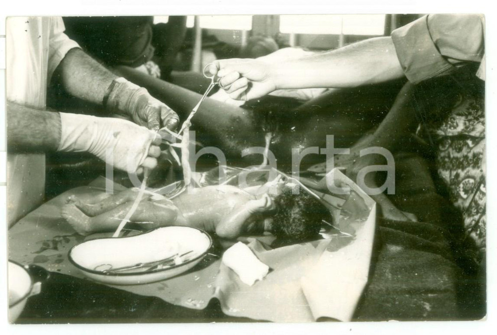 Fotografia d epoca originale 1970 ca MOZAMBICO Ospedale  Parto di una donna  Foto reportage medico 14x9 1
