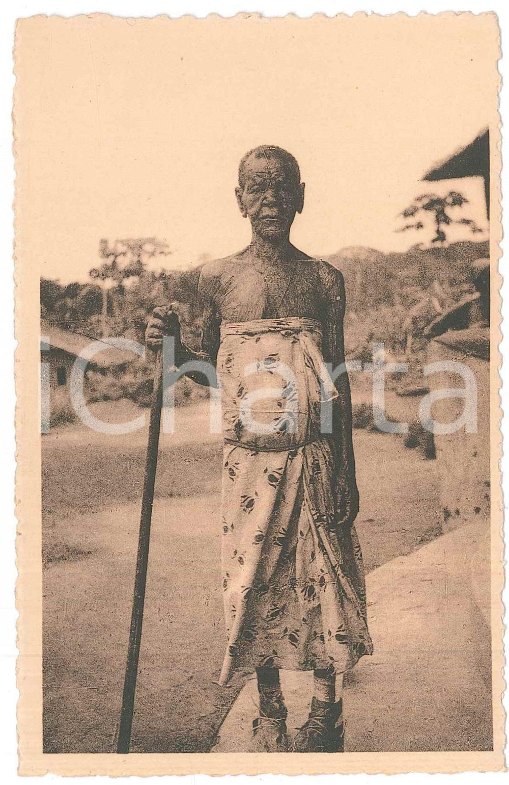 1930 ca LOMBOLOMBO WAFANDA Type de lépreuse - Forme lépromateuse ^Carte postale  Cartolina d'epoca, non viaggiata.  FAIR/discreto Lievi smussature agli angoli FORMATO: 14x9 originale e autentica 1