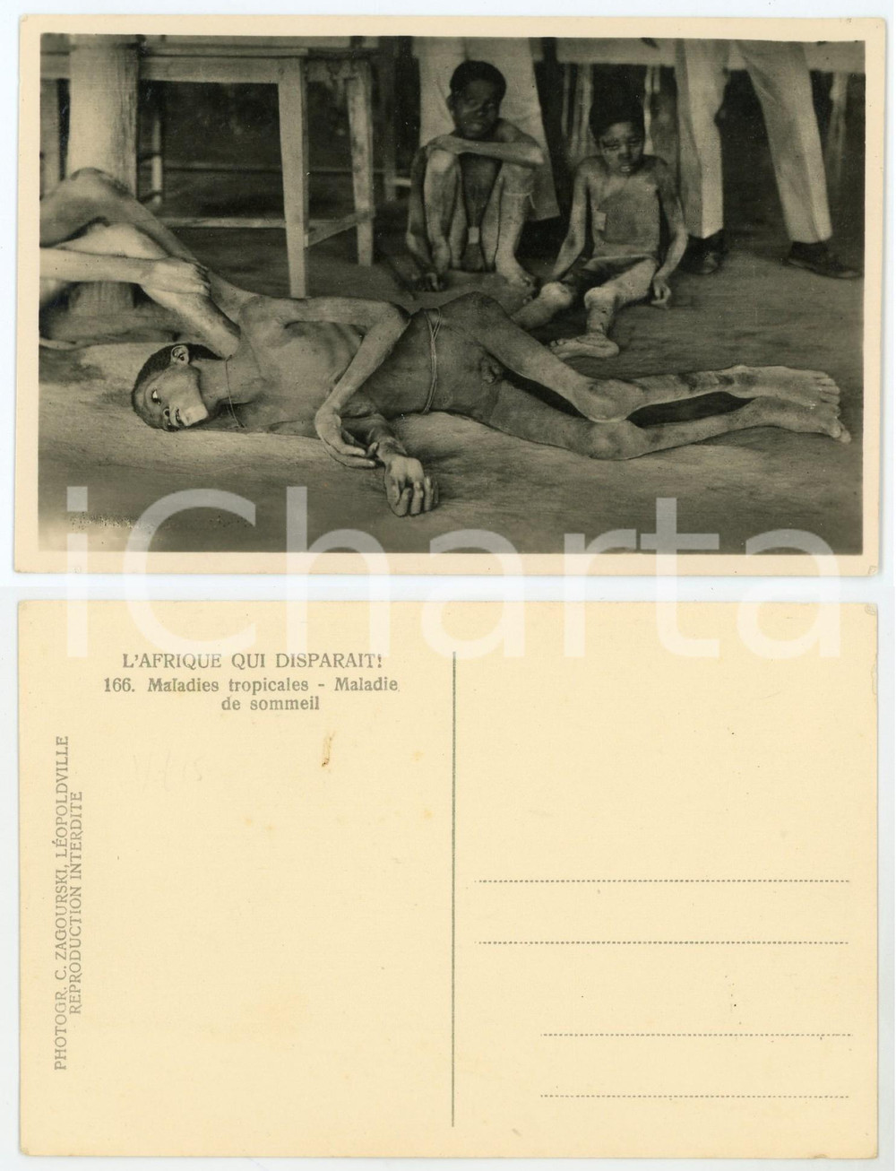 1930ca C. ZAGOURSKI «L'Afrique qui disparaît» Maladies de sommeil *Postcard 166  Fotocartolina postale d'epoca, appartenente alla serie «L'Afrique qui disparaît» del fotografo Casimir Zagourski (Léopoldville), non viaggiata.  FAIR/discreto  FORMATO: 14x9 cm originale e autentica 1